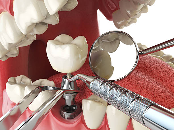 Best Broken or Cracked Tooth Emergency Dentist in Wickerham Manor Fisher, PA